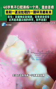 “太可惜了！”河南郑州一名40岁男子因口腔溃疡持续一个多月不愈，前往医院检查，竟