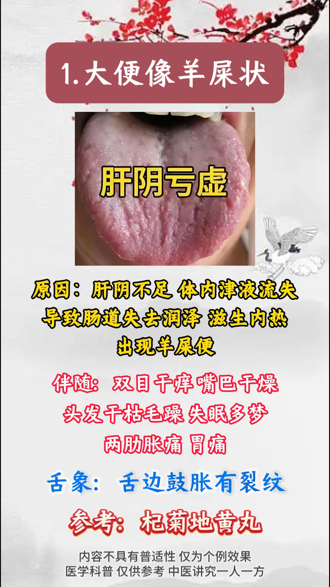肝好不好，看看大便就知道。