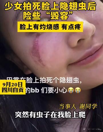 隐翅虫 风油精 风油精真的有用吗？爬过的地方都会被灼伤[裂开] ​​​