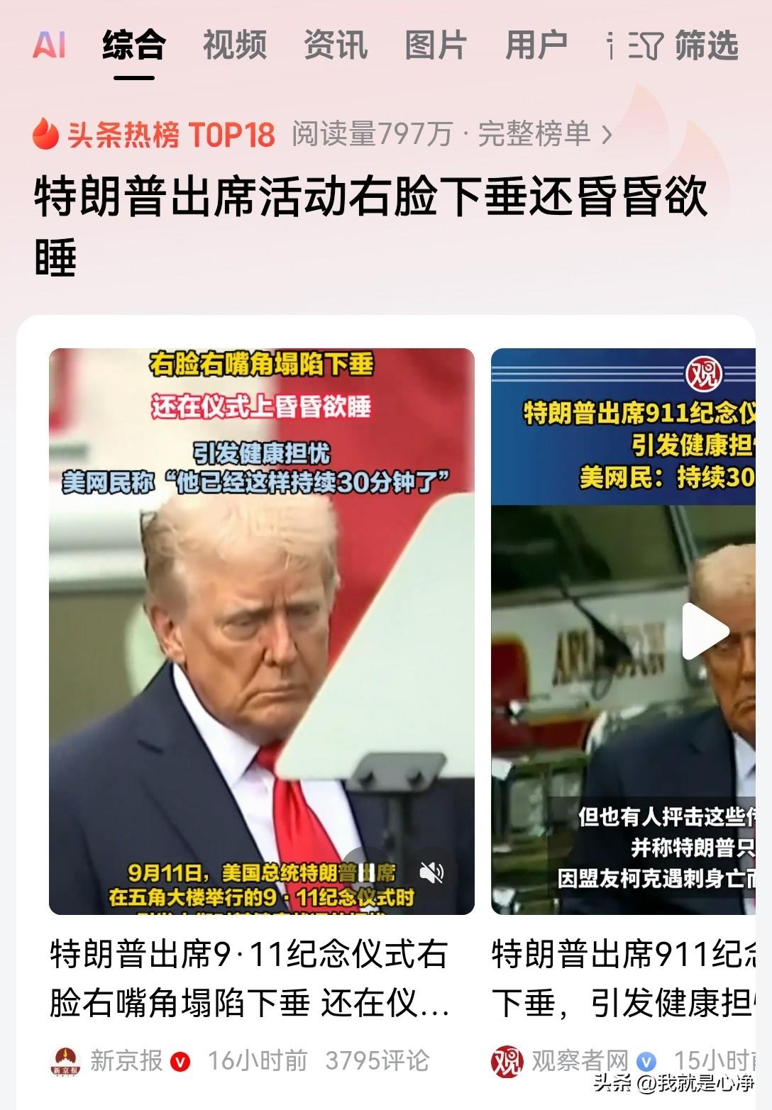 特朗普的情况很不乐观啊！身体健康情况堪忧！可能是这段时间诸多的不顺，对他的打击实