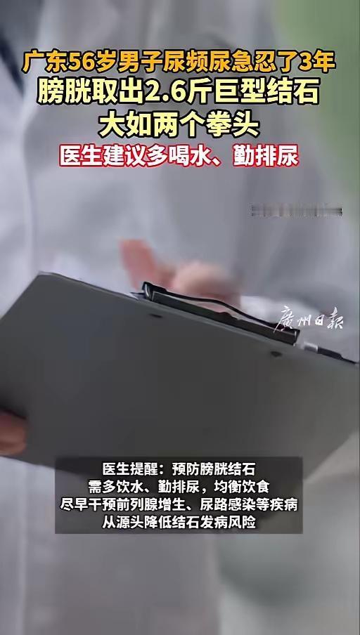别再硬扛！56岁男子憋尿忍3年，膀胱取出2.6斤巨型结石，教训太深刻
 
5月1