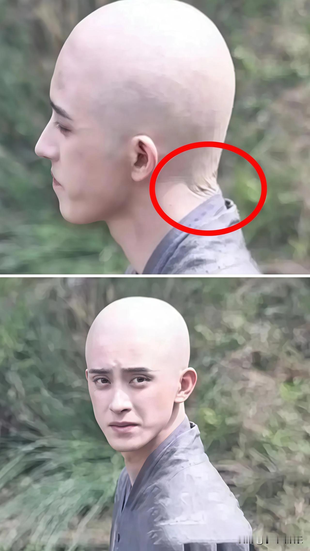 敖瑞鹏，求求你了，照照镜子看看这个假光头，你看着不别扭吗？

明明长了一张帅脸，