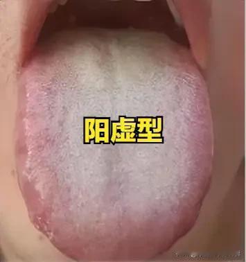 阳虚型“起立困难”：温补肾阳、固本培元，稳住身体根基
 
大家好，我是陈大夫！