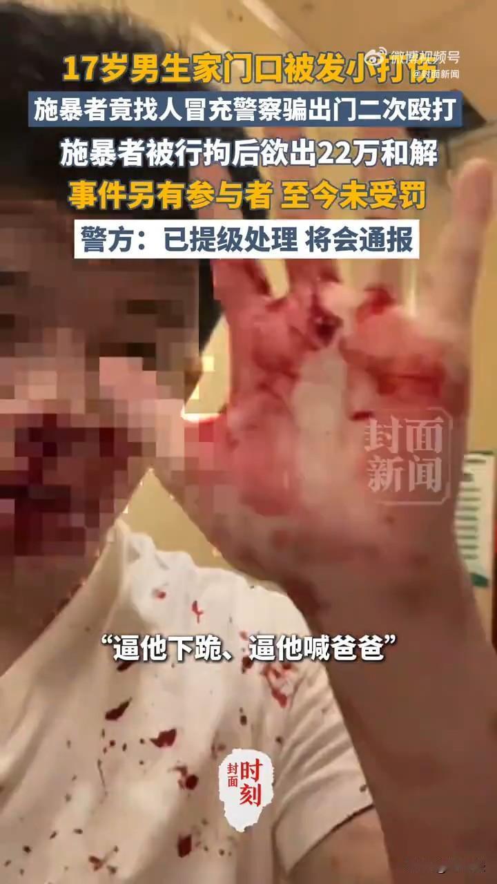 太嚣张了！伪装成民警骗受害人出来二次施暴，到底是谁给了施暴者勇气？

山西运城施