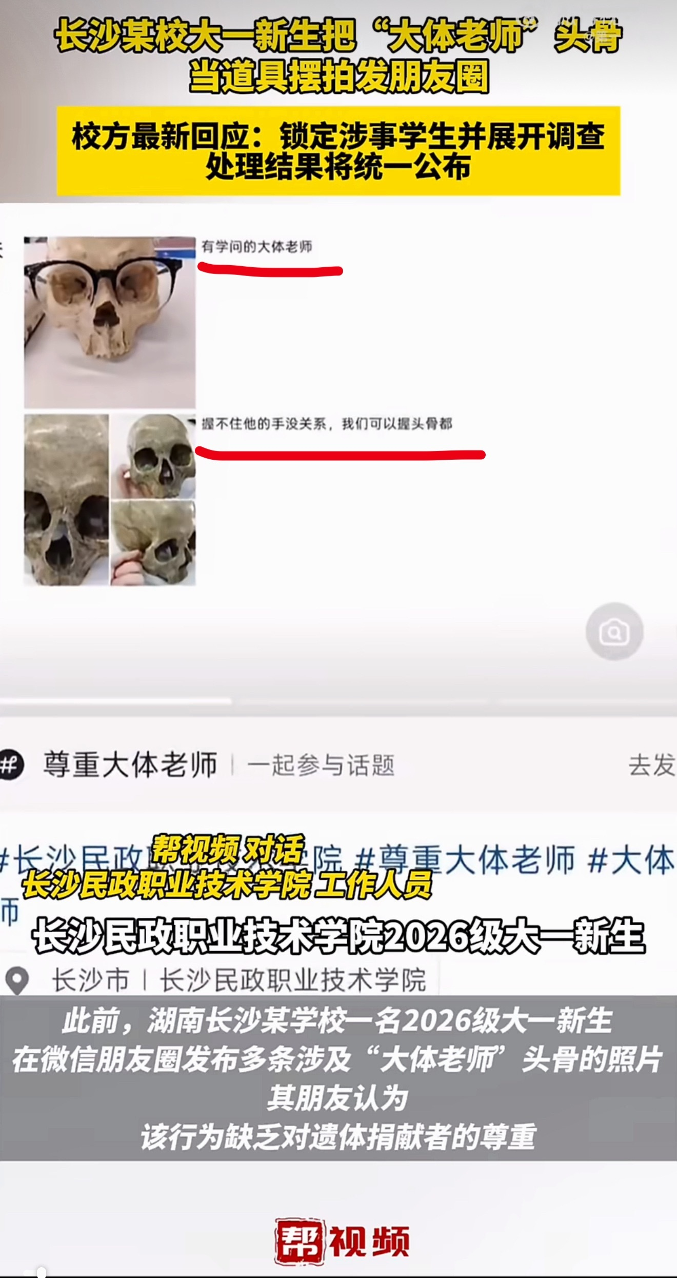 摆拍大体老师头骨学生被处分人品差成这样了，还学医呢，神人[笑cry] ​​​