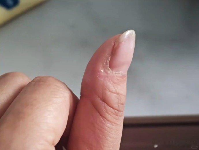 张凌赫也抠手单更果然出事，显微镜女孩上线，抓到张凌赫抠手！ 