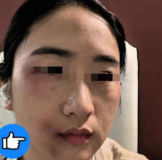 女子遭丈夫殴打，弟弟得知情况后，拿起家中的一根钢管赶到姐姐家。是姐夫开的门，弟弟