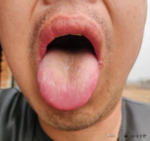 说啥啥不听，说你是个 “怨种” 真是一点都不委屈你[狗头][狗头][狗头]
药吃