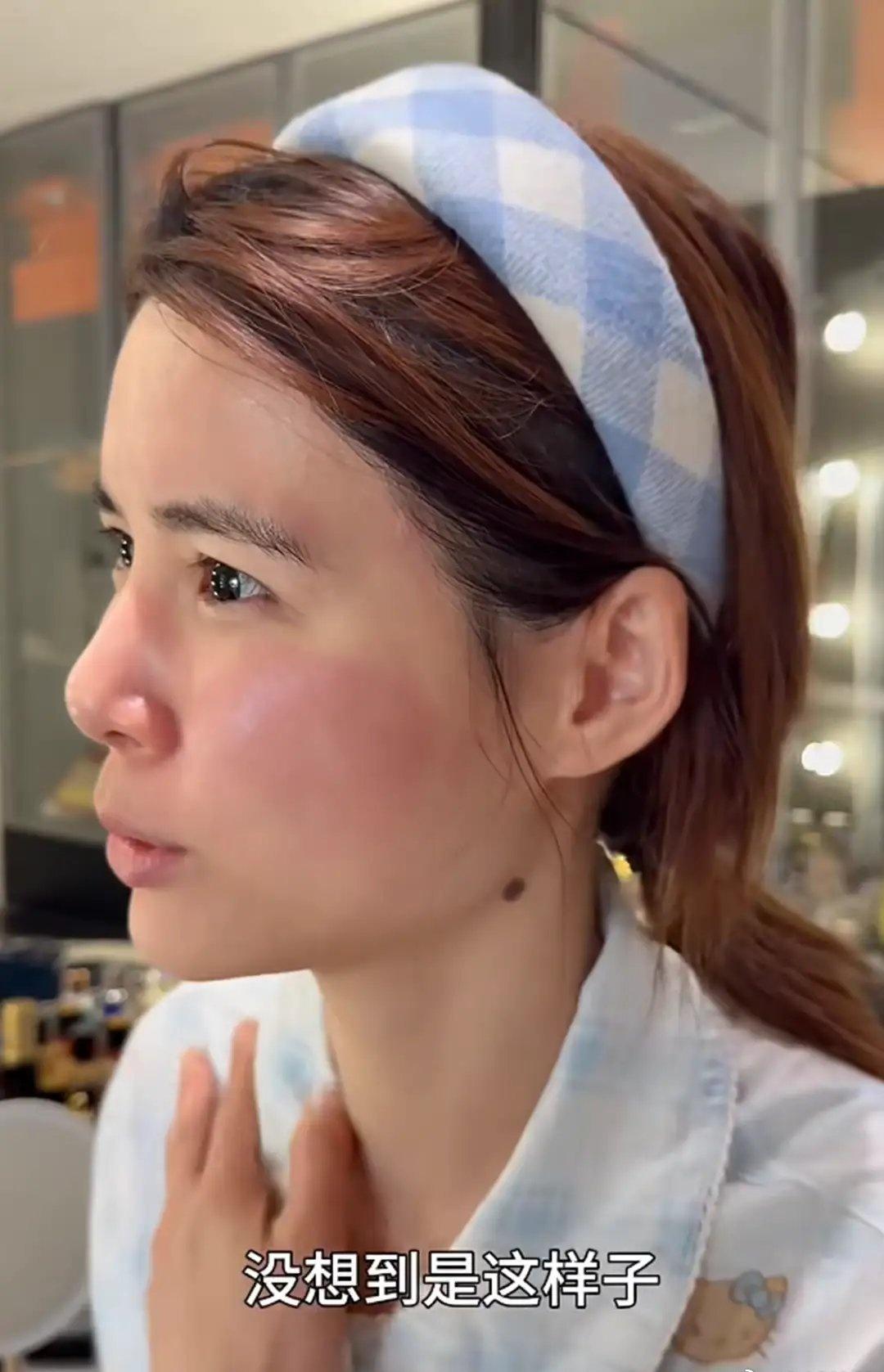 苏醒老婆用护肤品脸过敏红肿更让人心里一紧的是，这瓶爽肤水还不便宜。她说是之前度假