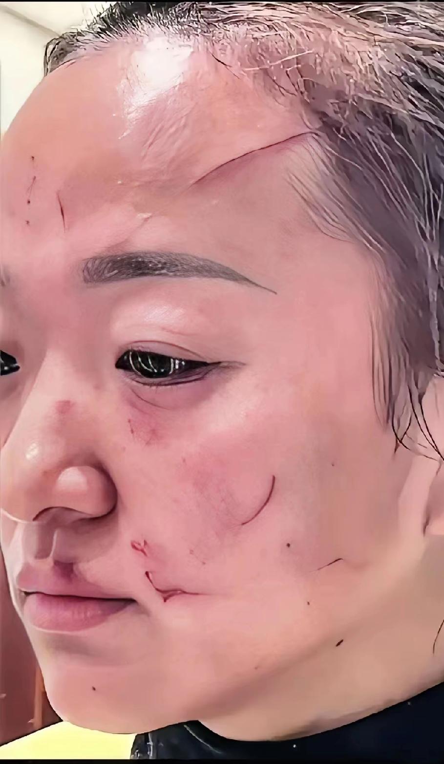 女儿昨天又让女婿打了，我气的是恨铁不成钢，女儿结婚六年，女婿打了六年，女儿爱唠叨