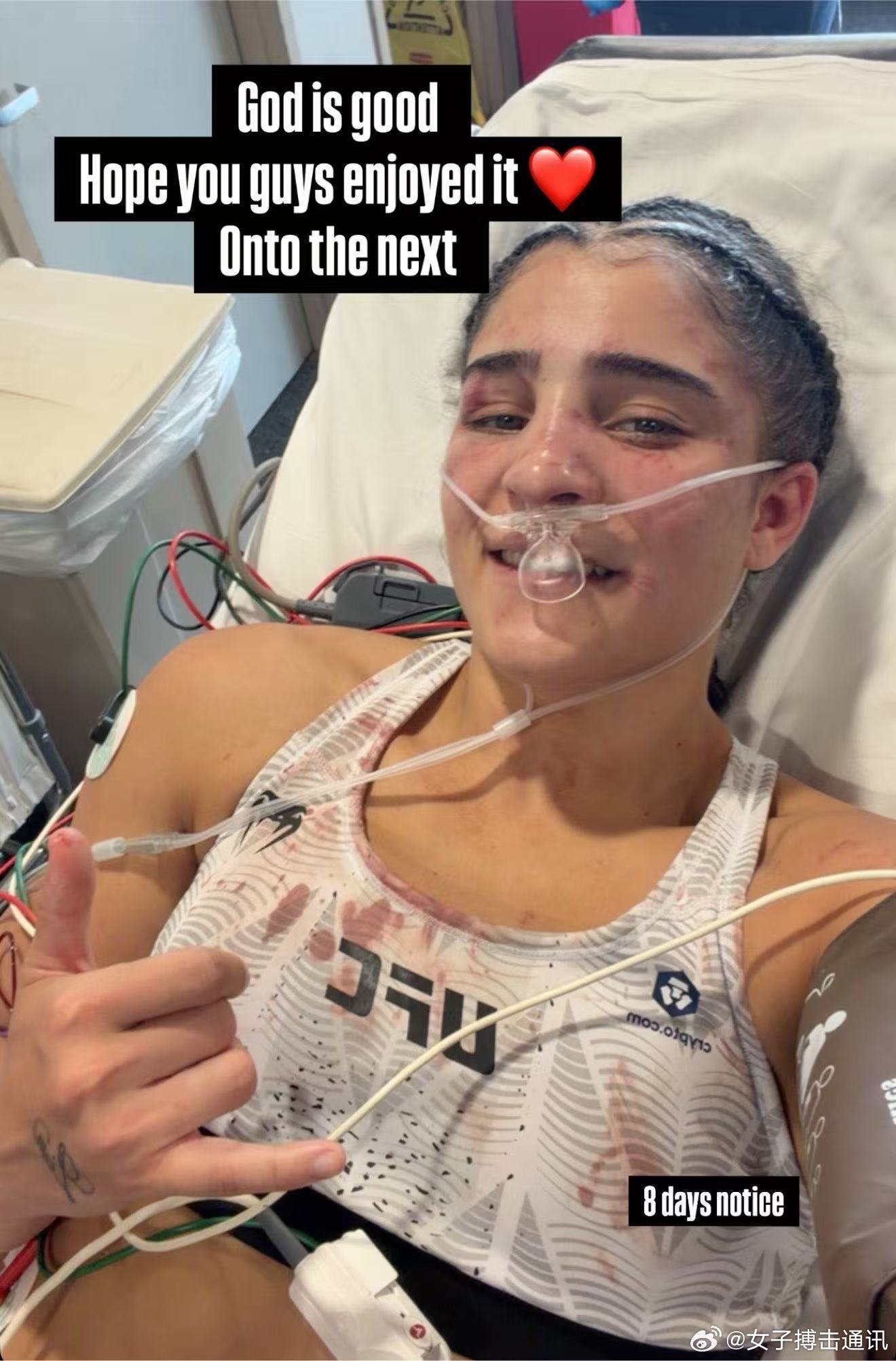 UFC GIGI CANUTO在赛后被送往医院——23岁的年轻选手，提前8天预定