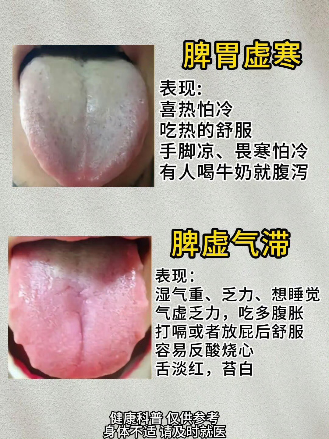 脾胃不好的6种舌苔，看看自己是哪一种？  