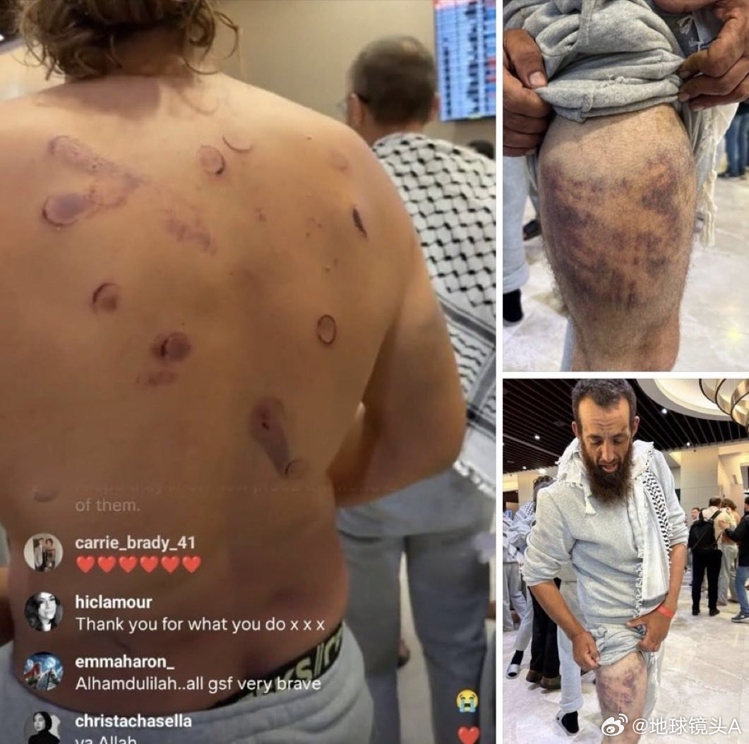 被以色列纳粹释放的一批“全球苏穆德船队”抵达伊斯坦布尔后，向媒体展示了他们遭到以
