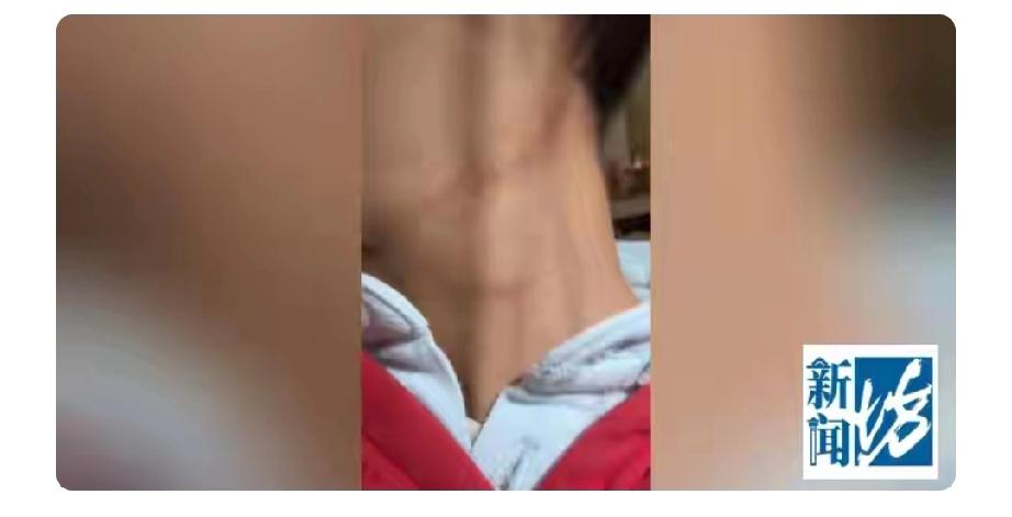 上海，女子带7岁的儿子到某医学中心做鼻腔镜检查，不料，孩子因害怕拒绝配合，医生瞬