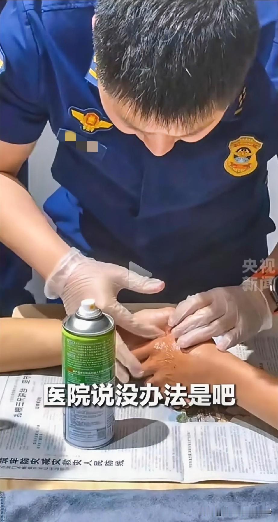 两个男孩

碰倒桌子洒了大量502胶水，

双手被粘得牢牢的，先去医院

说没办