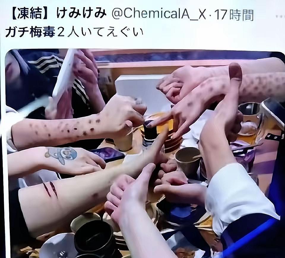 拿命赶潮流？日本女孩流行晒“梅毒妆”，身上红疹成社交货币，网友看傻

我真服了。