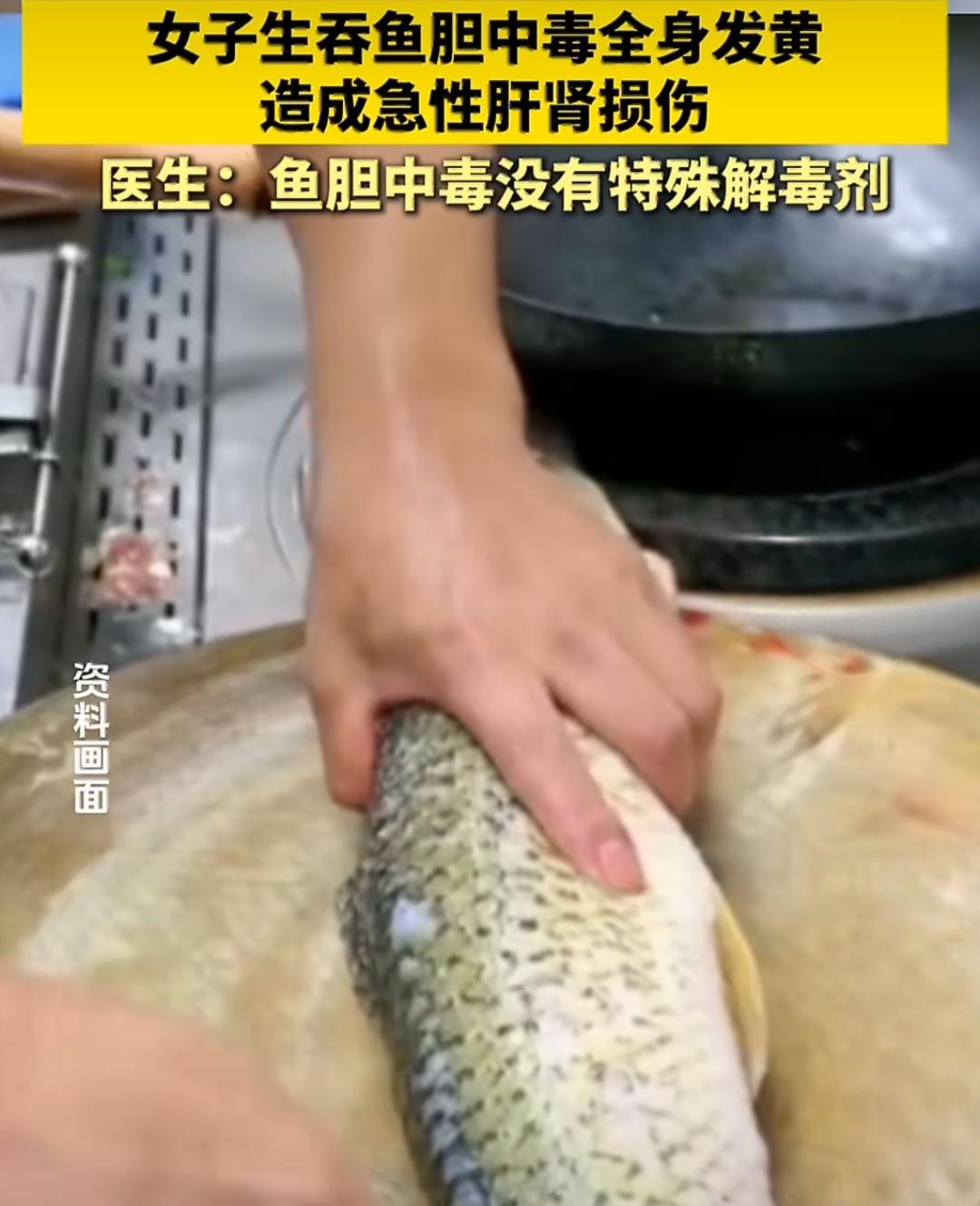 吓懵！大妈生吞鱼胆想“治病”，结果全身发黄住进医院。

南京的王阿姨在家杀鱼时，