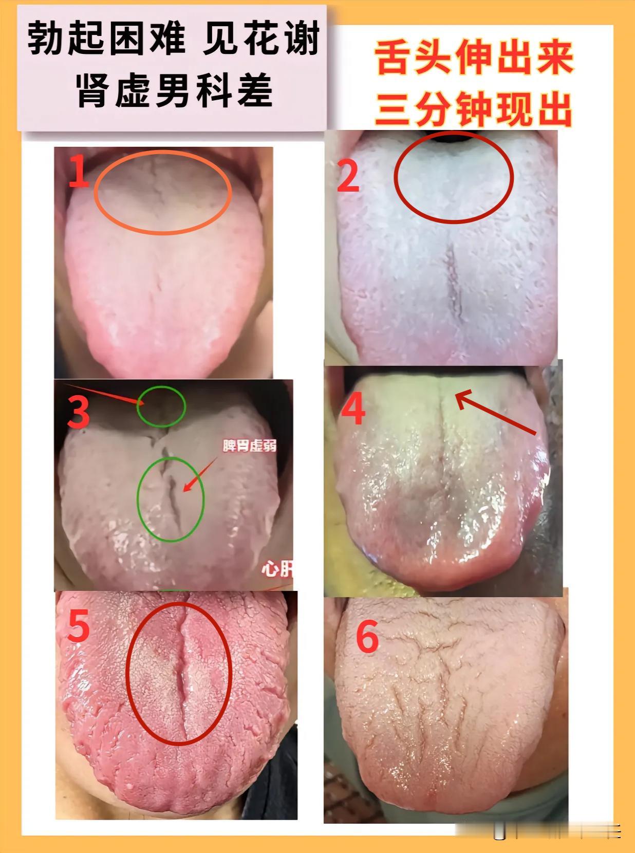 转眼又到周五了，今天还是老样子，给大家看舌象！

只要你发，我就看，不怕看不完，