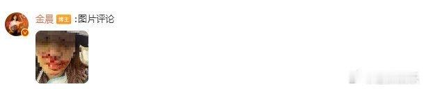 金晨道歉金晨今天为去年的单车事故道歉，承认当时是自己驾车，助理因“事发突然、情绪