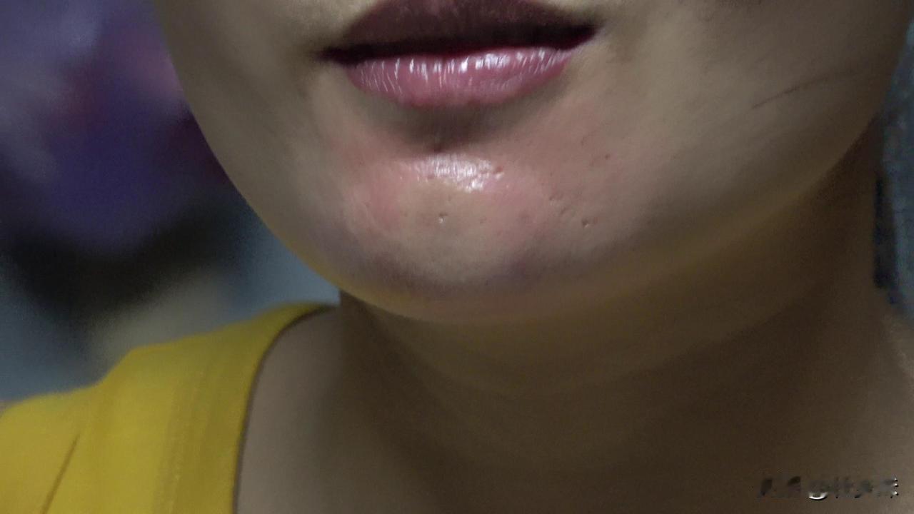 被蜜蜂蜇厉这样，脸都变形了，55555555，这下什么出门？