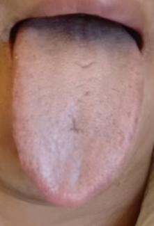 脾胃湿热壅滞，也是男性身体亏虚的调理关键







有位粉丝跟我倾诉，年轻的