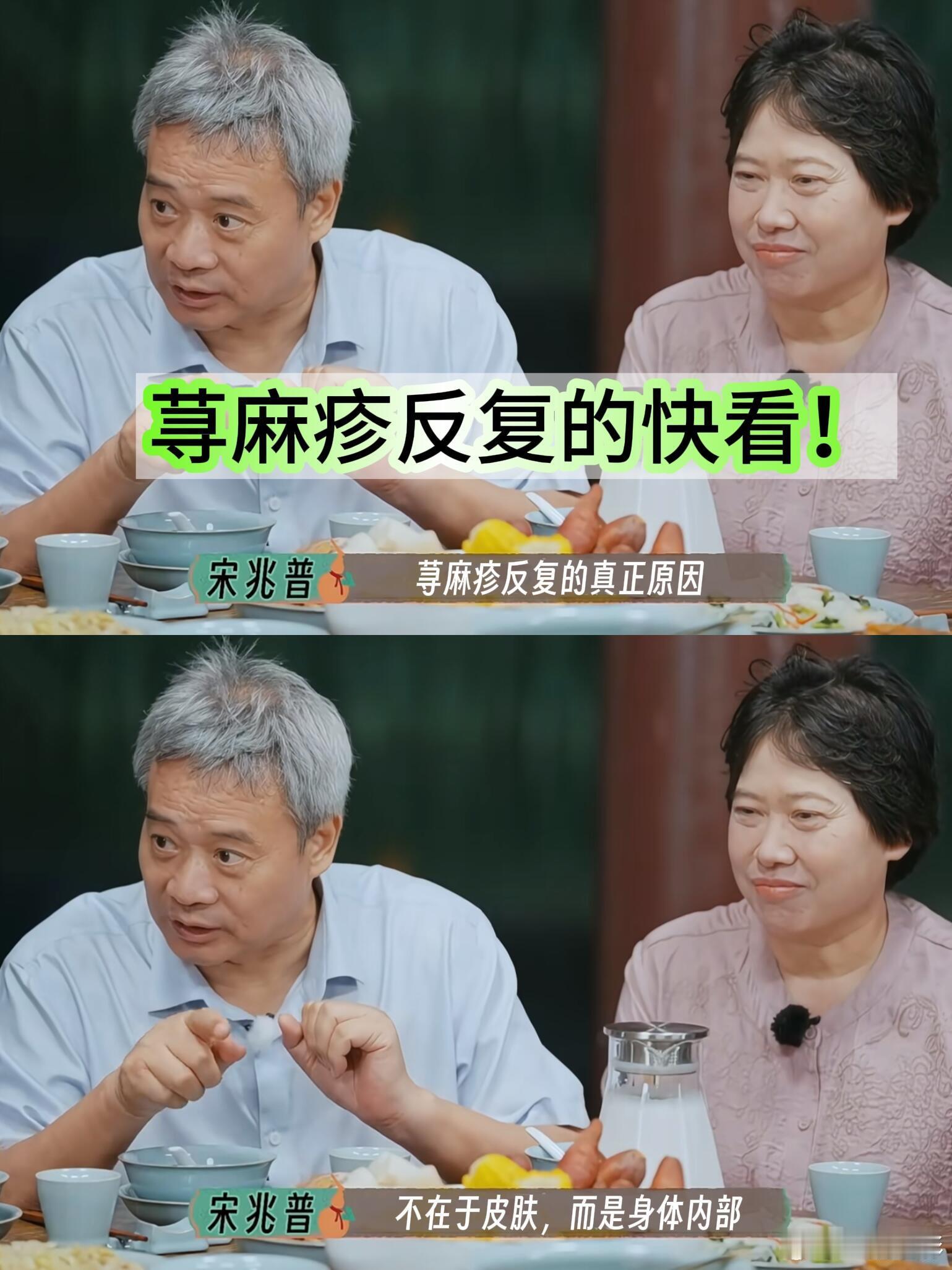 反反复复的荨麻疹被综艺拯救了。 