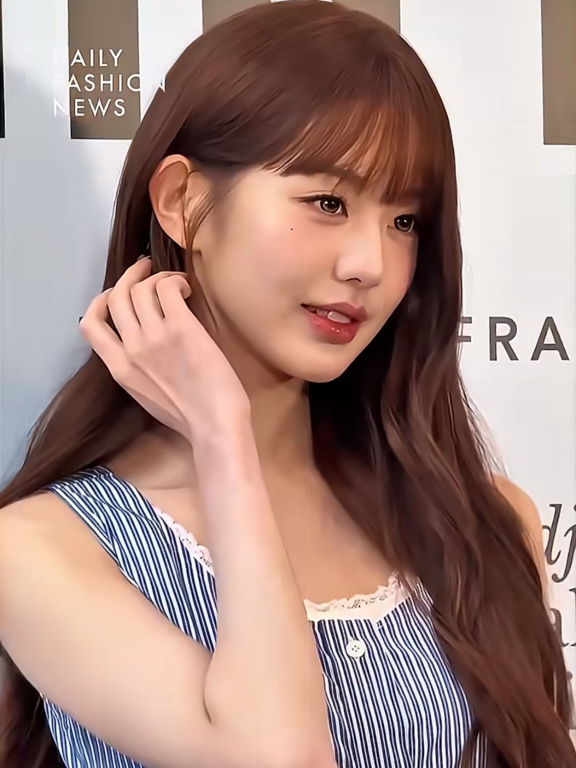 张元英下颌缘淤青同天的状态很好谢谢 又莫名其妙给我女神买嘿rs干嘛 一会说是这个
