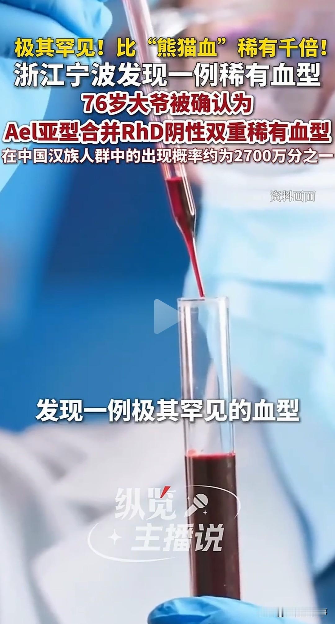 极其罕见！

活了76年从没查过血型，宁波大爷骑车摔了一跤，竟查出了全中国都没几
