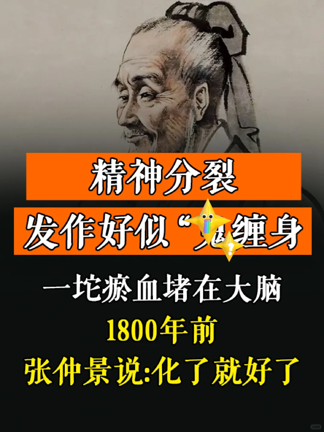 精分发作好似“gui缠身，一坨瘀血堵在大脑，1800年前，张仲景说:化...