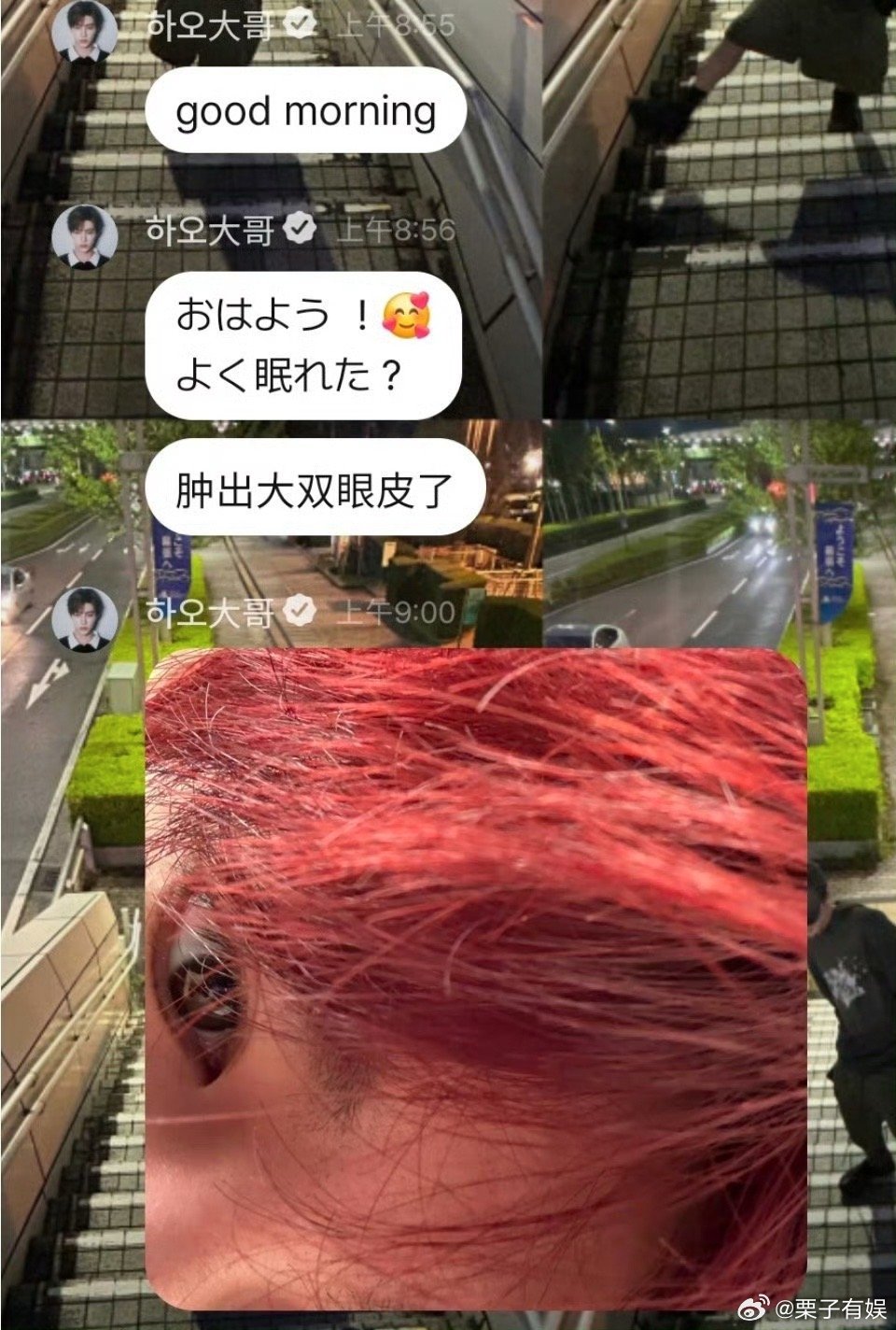 章昊肿出大双眼皮了章昊肿出双眼皮了章昊肿出大双眼皮了，哈哈萌，[太开心][太开心