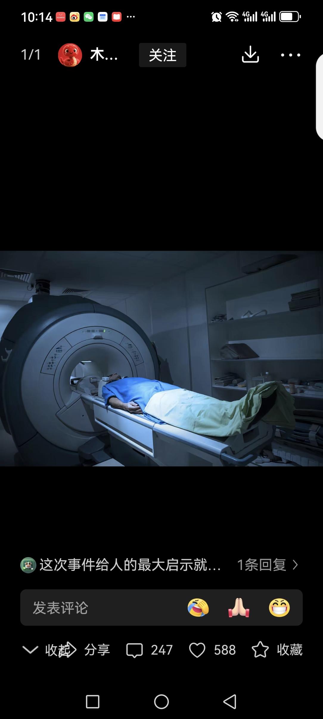 男子被遗忘在核磁共振设备上六小时，这件事情引发了不少网友热议！
我觉得，这件事情