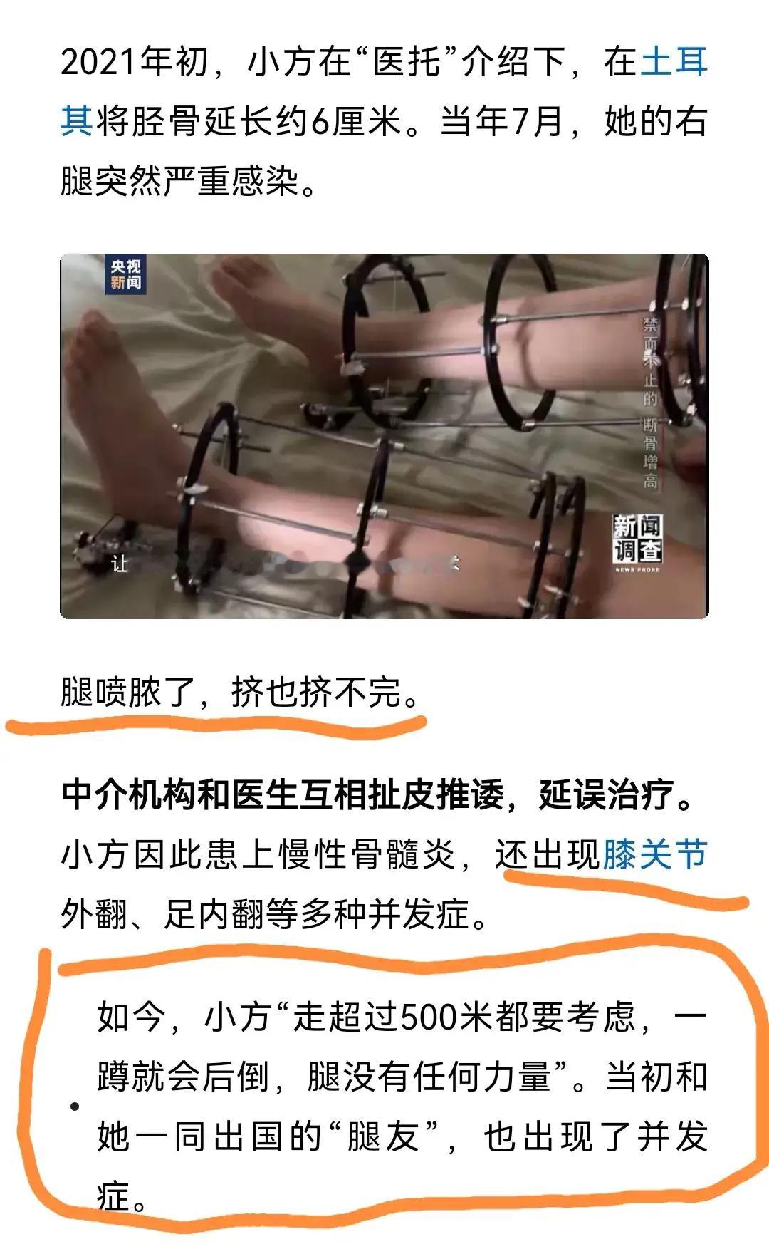 央视曝断骨增高灰色产业链 过去你听说过“断骨增高术”吗？为了长高几厘米，有人不惜