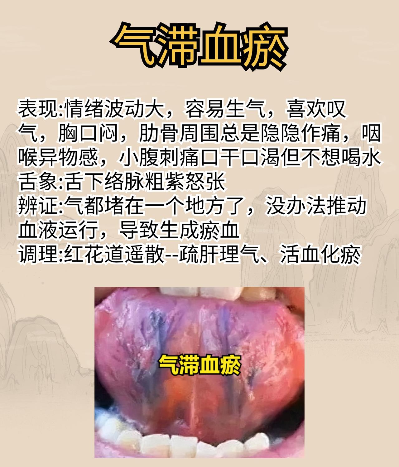 血瘀也分好几种，快来看看你属于哪一种#中医##养生##科普#