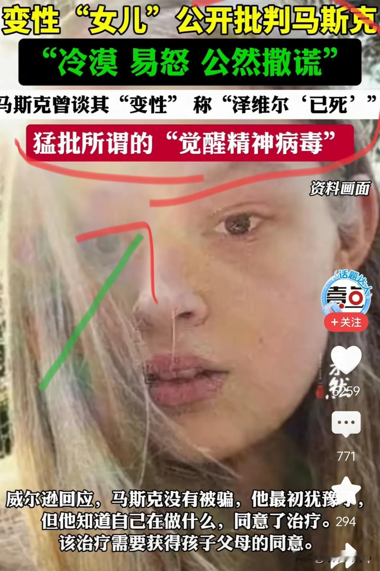 忽然感觉马斯克也是个极端自私保守的家伙，就这思想还想去火星，连自己孩子的选择都包