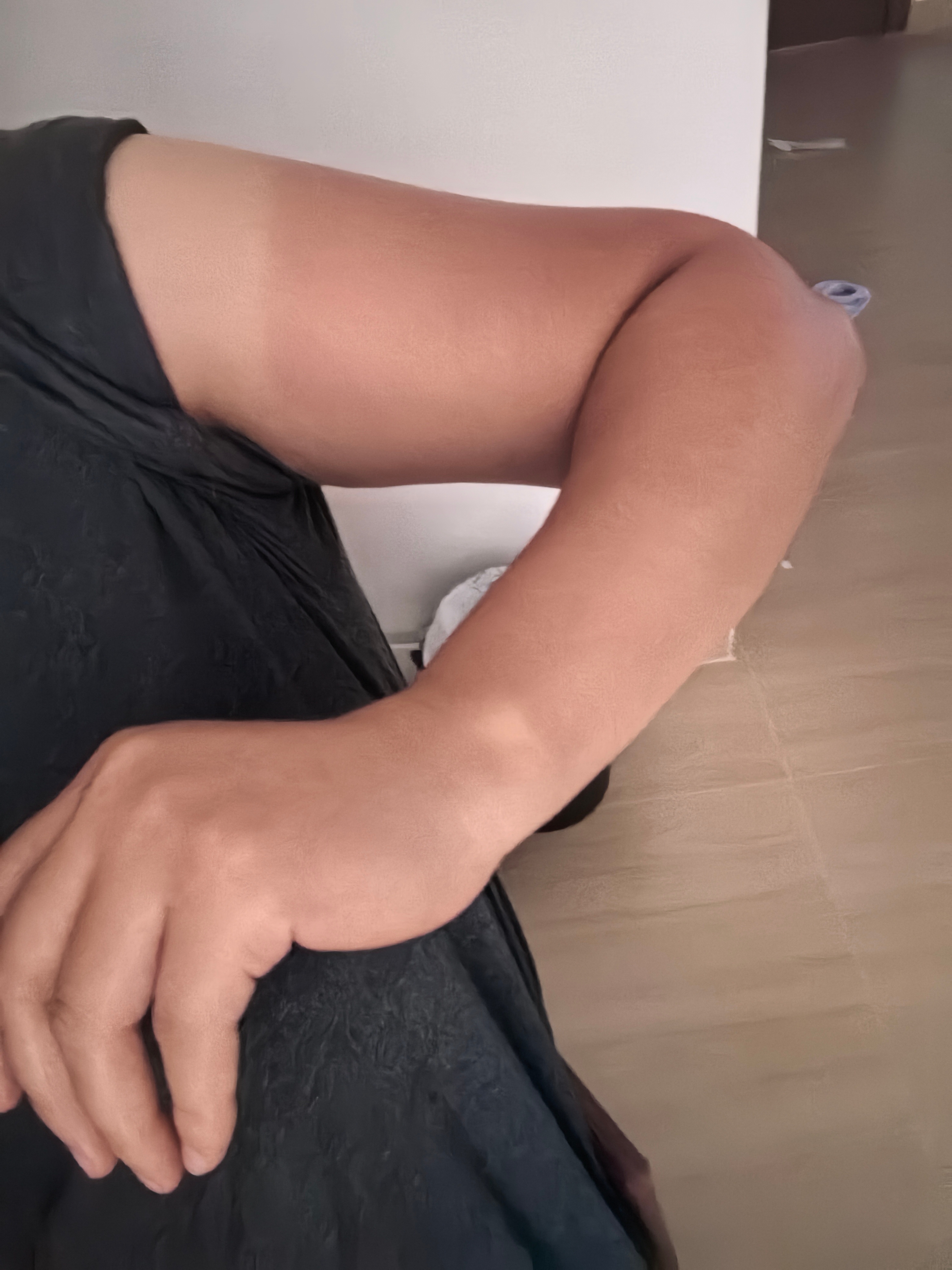 我的胳膊现在还辣辣的，咋整 
