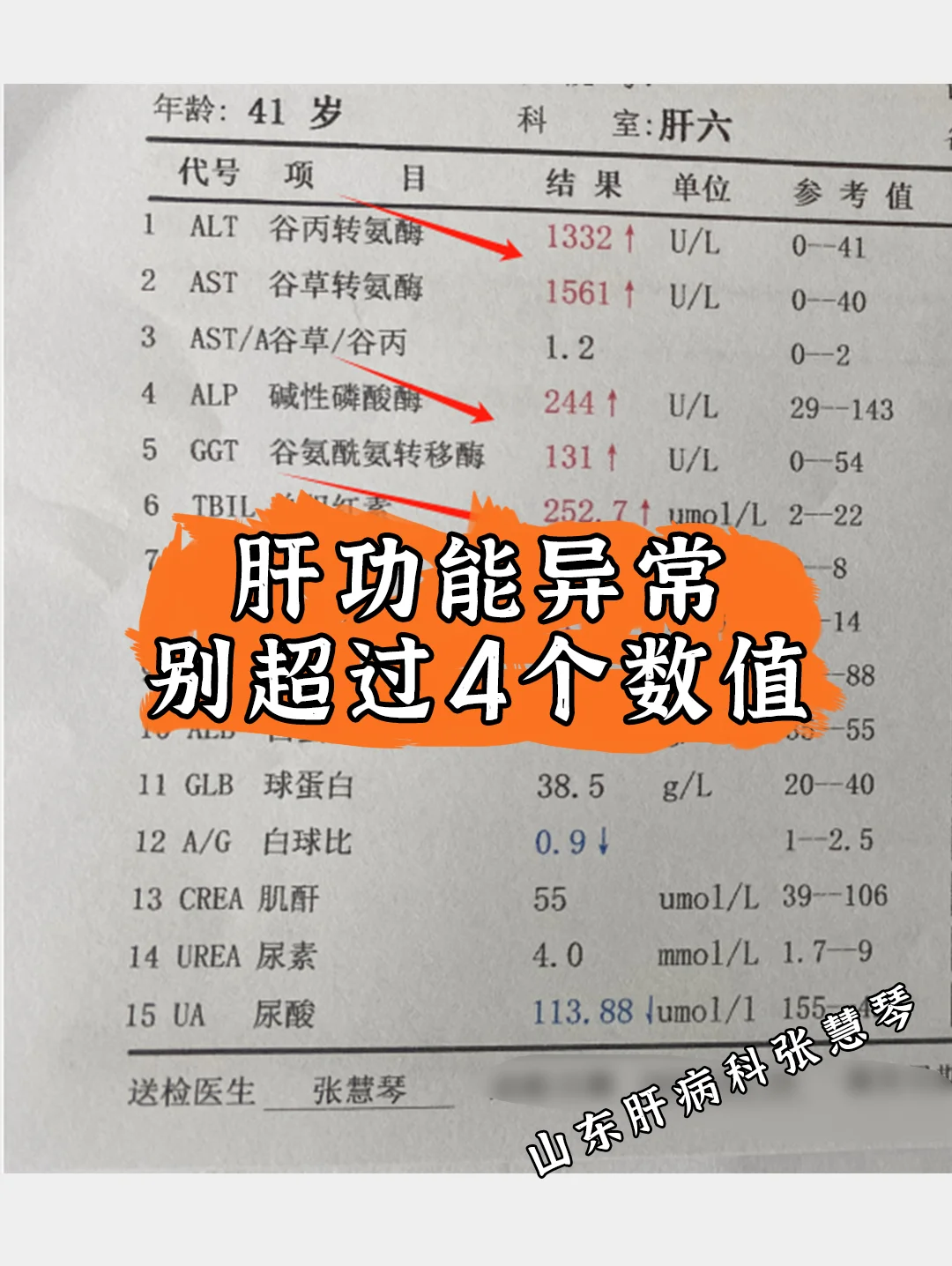 肝功能异常只要不超过这4个数值不是大问题