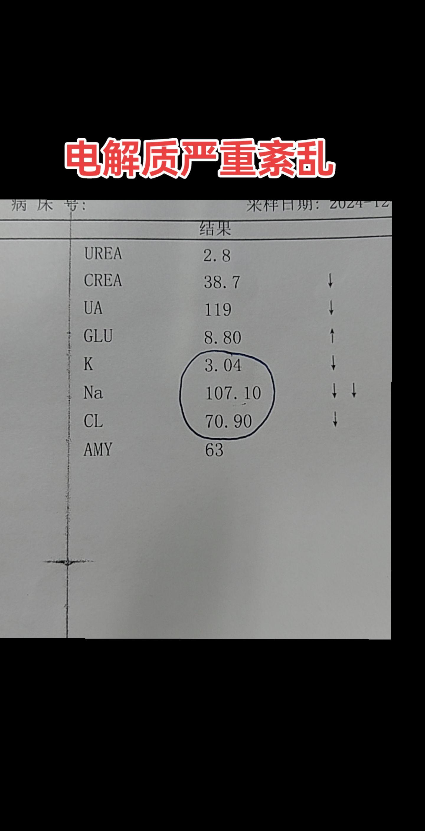 电解质紊乱。患者近一周来频繁呕吐腹泻、纳差，引起严重电解质紊乱：低钾低...