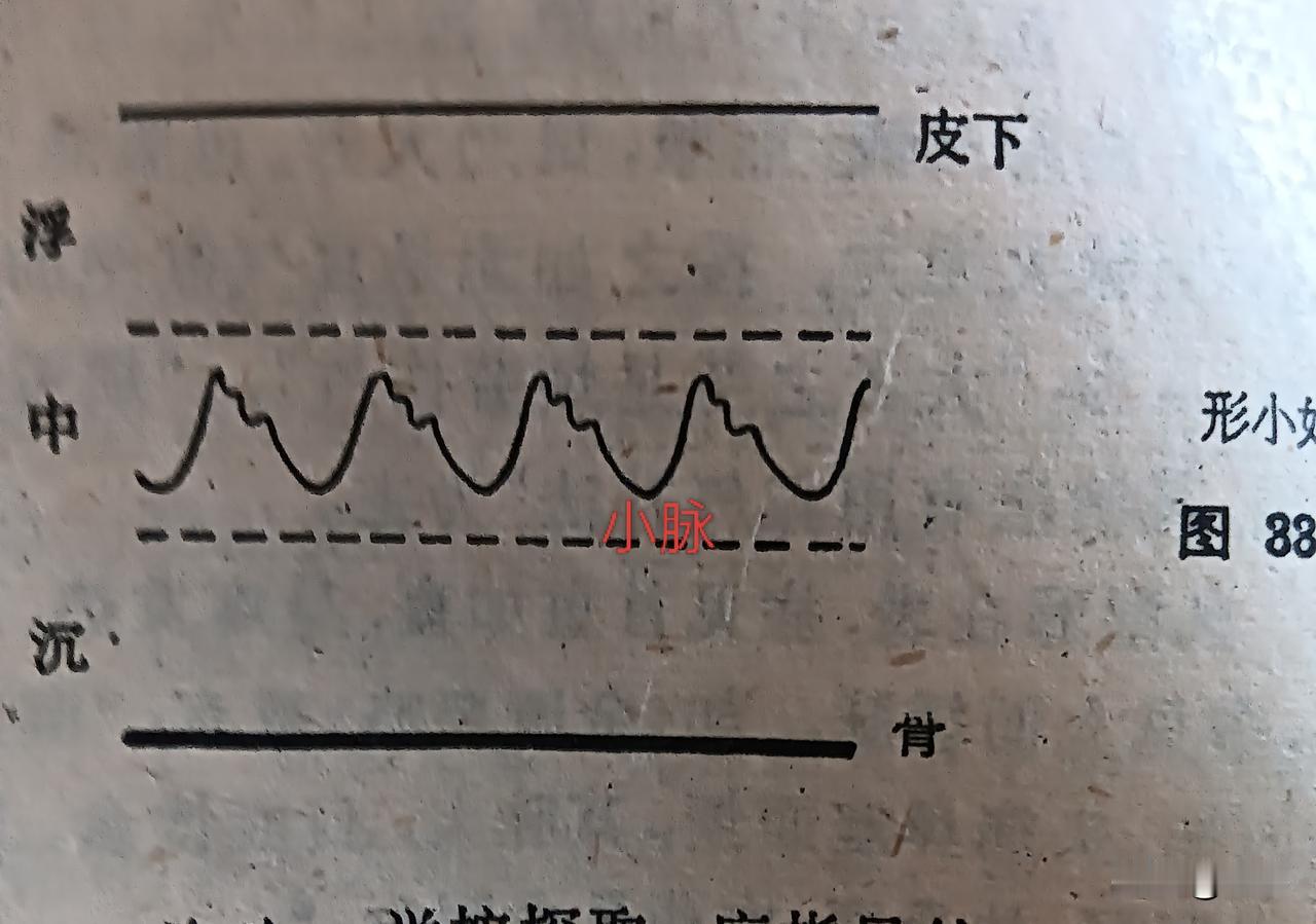 但并不是所有的疾病都需要诊脉。中医界认为，疫症重于症，杂症重于脉。就是一切外感病