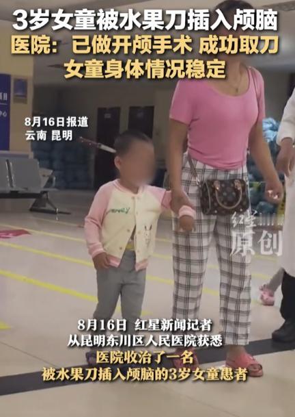 [微风]“心真大！”云南昆明，3岁女孩玩耍时，不慎将水果刀插入头颅，妈妈看到后，
