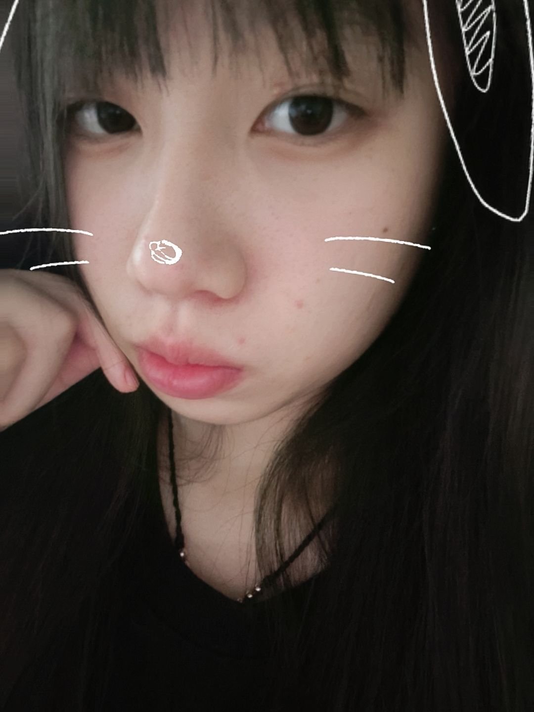 烦死了 一来学校就长痘痘…… ​​​