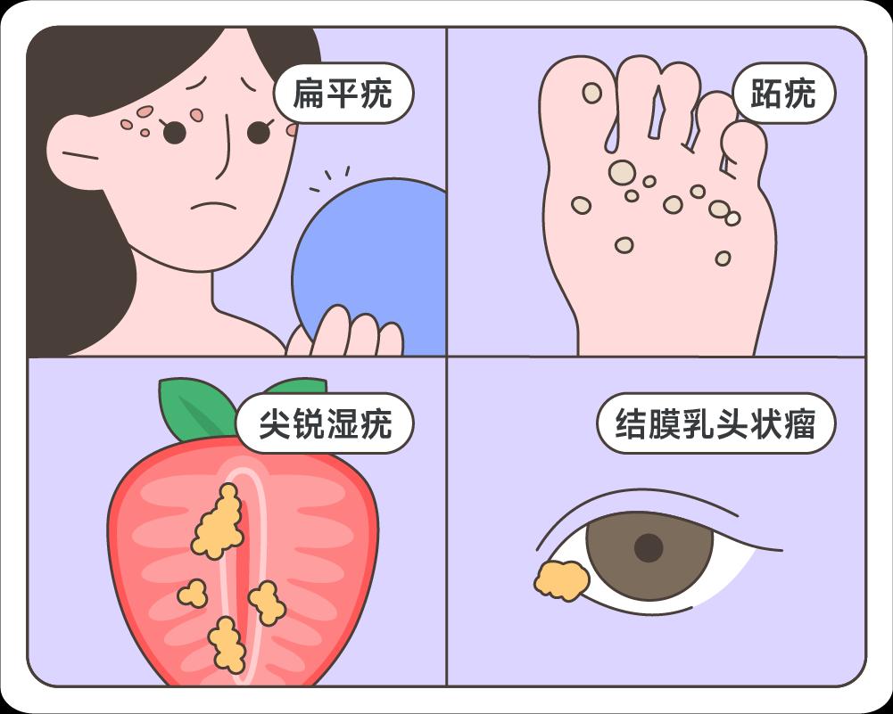 感染HPV后，外貌最明显的5个变化，女性千万别忽视！

很多患者来找我，一进门就