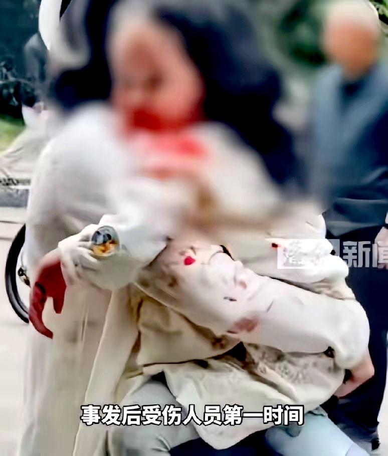 我建议对四川眉山仁寿县那个遛狗的人严惩，因为她给那么多无辜的人造成了重大伤害，必