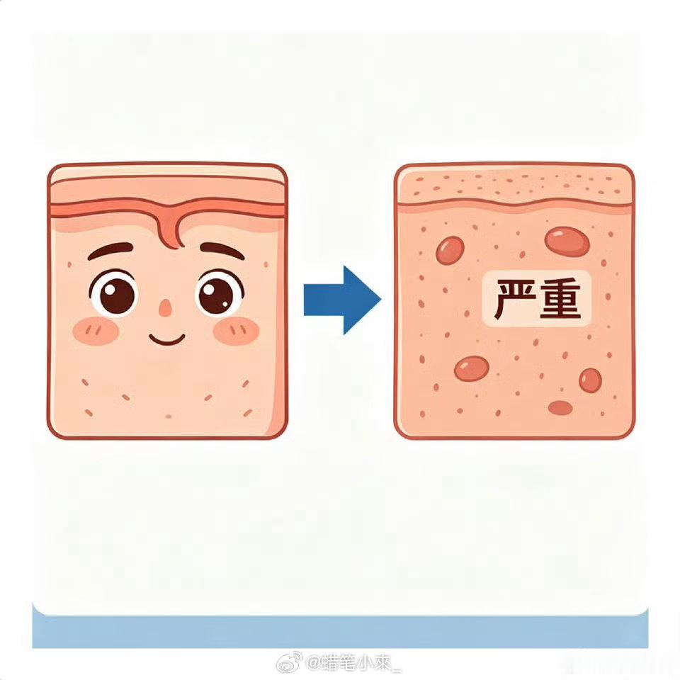 以为没事但很严重的皮肤病 背上的小红点以为是蚊子包，拖成慢性炎症；头皮脱屑当头屑