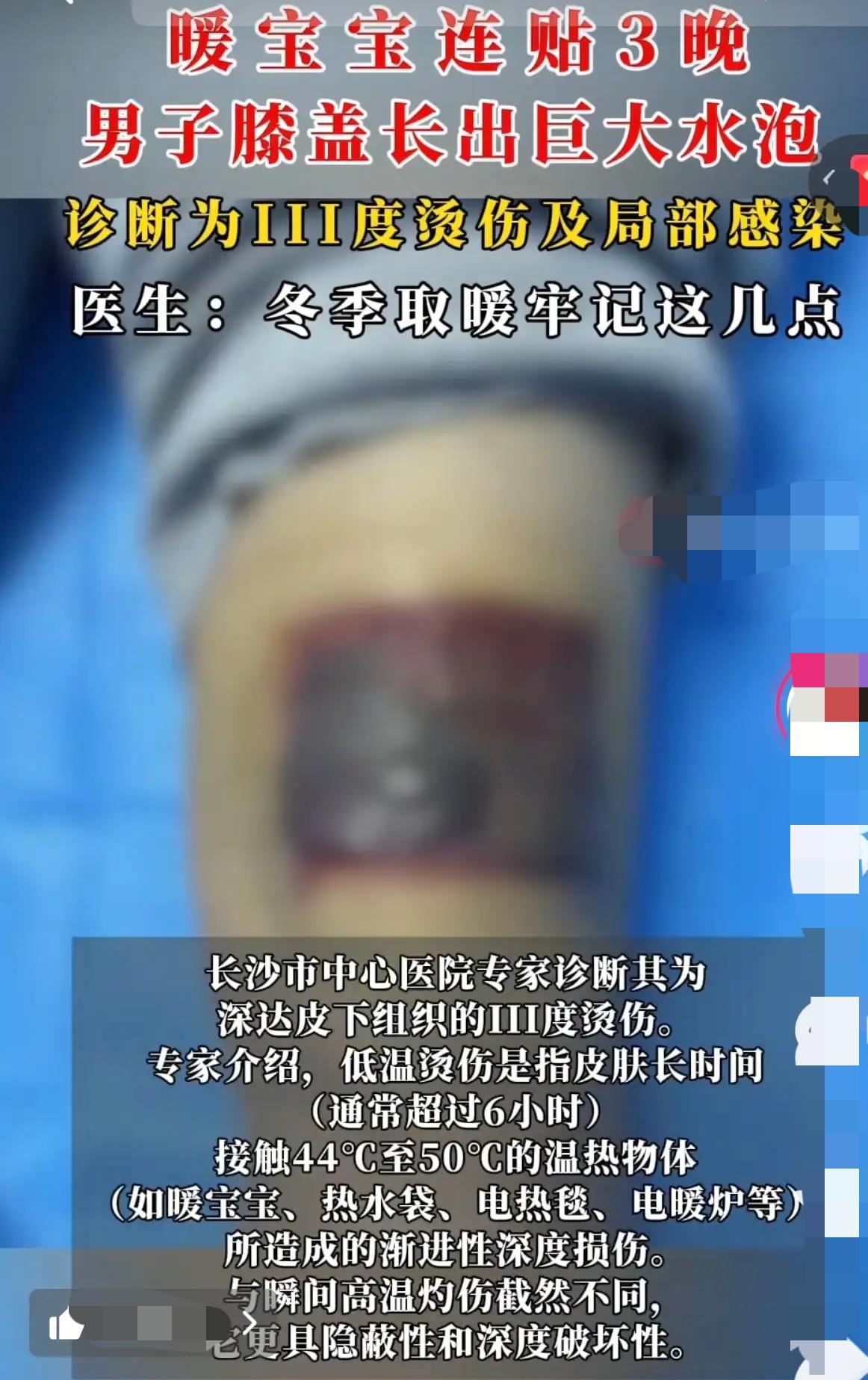 【长沙一大哥图舒服连贴3晚，揭下来那一刻，全家吓懵！】
老铁们，这大冷天的，暖宝