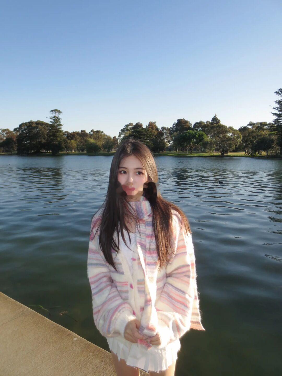 AlbertPark🏖️