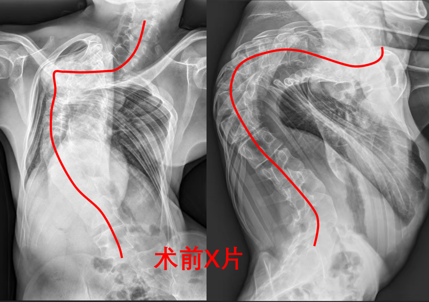 “终于能以正常人的视角平视世界了！” 两封感谢信背后是24岁大学生的重生