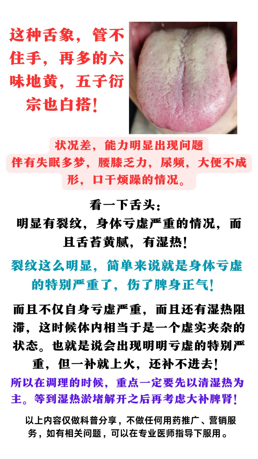 这种舌象，管不住手，再多的六味地黄，五子衍宗也白搭！#健康科普##中医##中药#