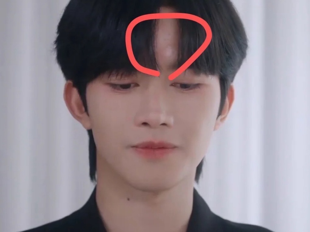 化妆师你睡了吗有没有人管管黄星的蚊子包 ​​​