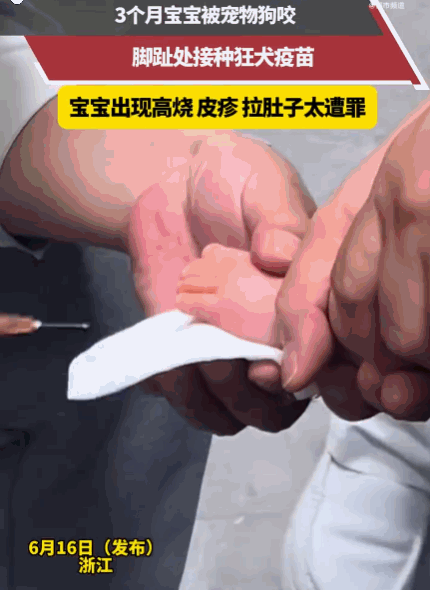 防不胜防！浙江，一个才3个月的宝宝正乖乖喝奶，却突然被一条野狗咬住脚趾，虽然第一