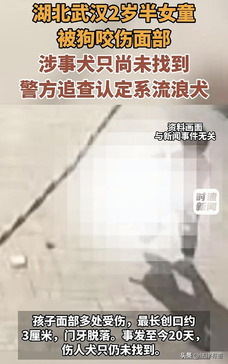 2岁半女童遭流浪犬撕咬！2026年7月24日晚9时许，武汉蔡甸区，2岁半的小瑜在